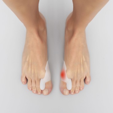 InnovaGoods 用于大脚趾斜关节的硅凝胶矫形罩（布尼里夫） 2 个一组