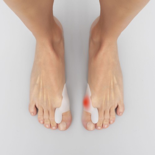 InnovaGoods 用于大脚趾斜关节的硅凝胶矫形罩（布尼里夫） 2 个一组